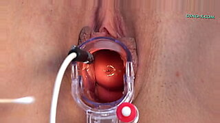 dr and girl patient broken her vagina with cum