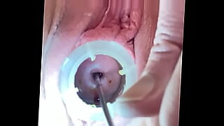 pain finger