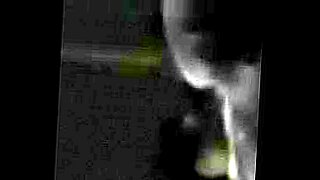 milk bleeding