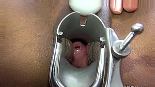 medical spy cam